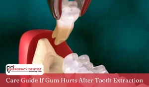 Care Guide If Gum Hurts After Tooth Extraction