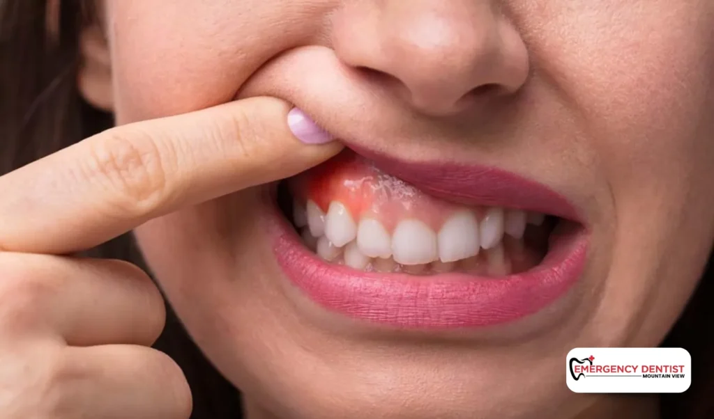 When Gum Pain Is Normal vs. a Concern