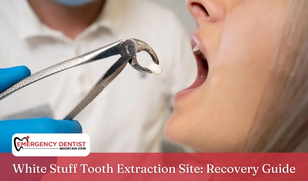 White Stuff Tooth Extraction Site Recovery Guide