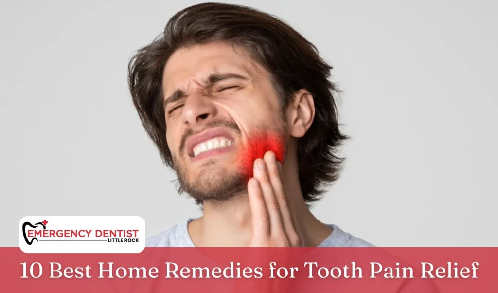 10 Best Home Remedies for Tooth Pain Relief