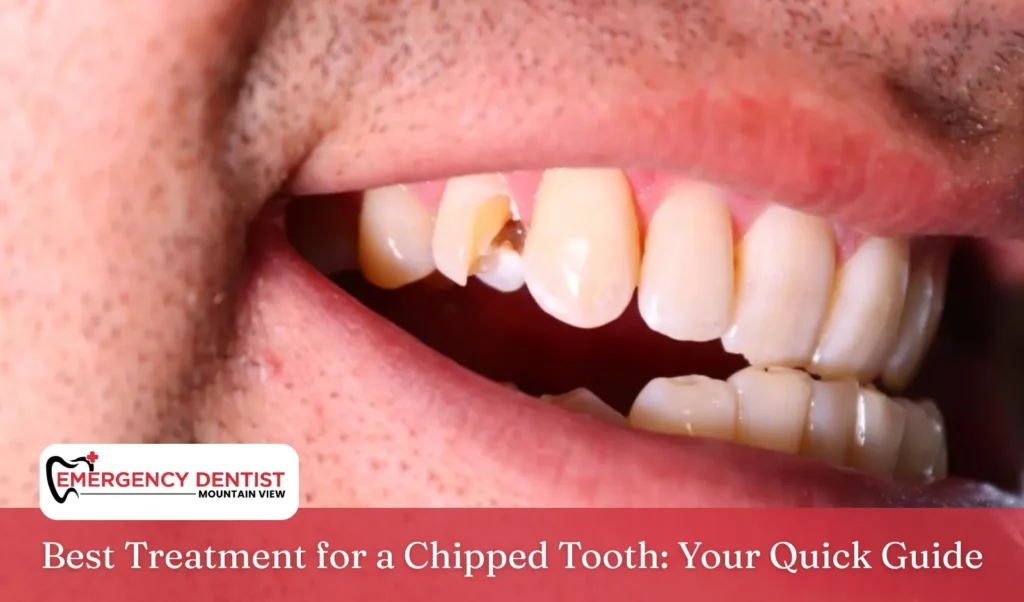 Best Treatment for a Chipped Tooth Your Quick Guide