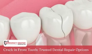 Crack in Front Tooth Trusted Dental Repair Options