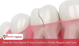How Do You Know If You Cracked a Tooth Repair and Care