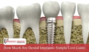 How Much Are Dental Implants Simple Cost Guide