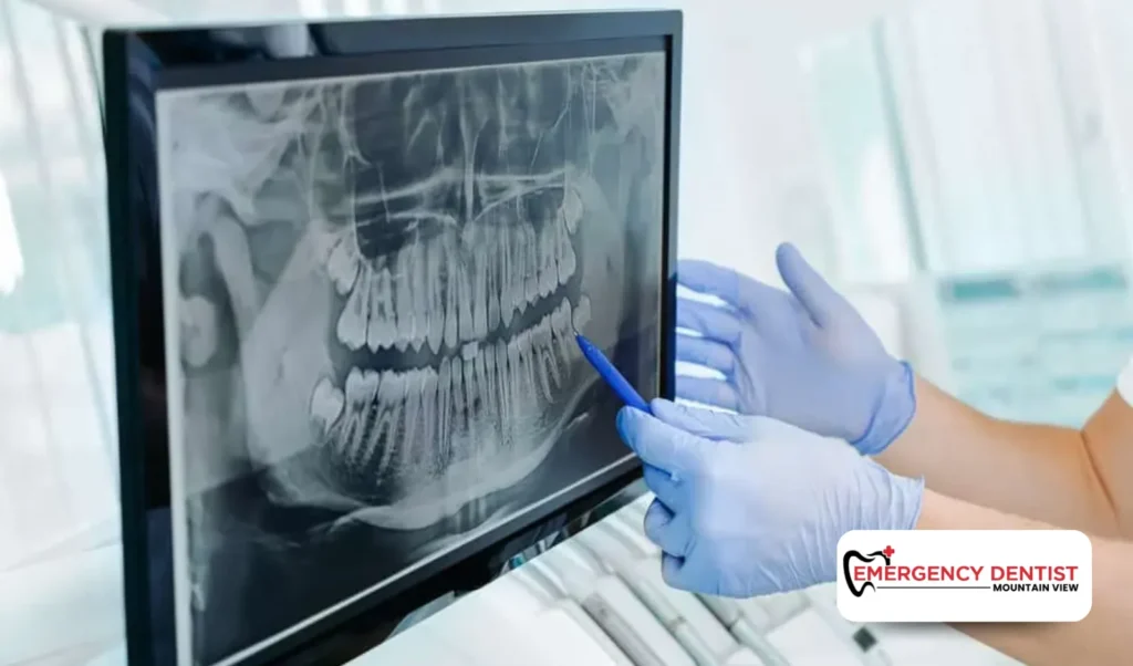 Step-by-Step Dental Implant Procedure