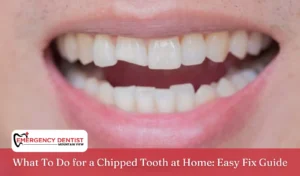 What To Do for a Chipped Tooth at Home Easy Fix Guide