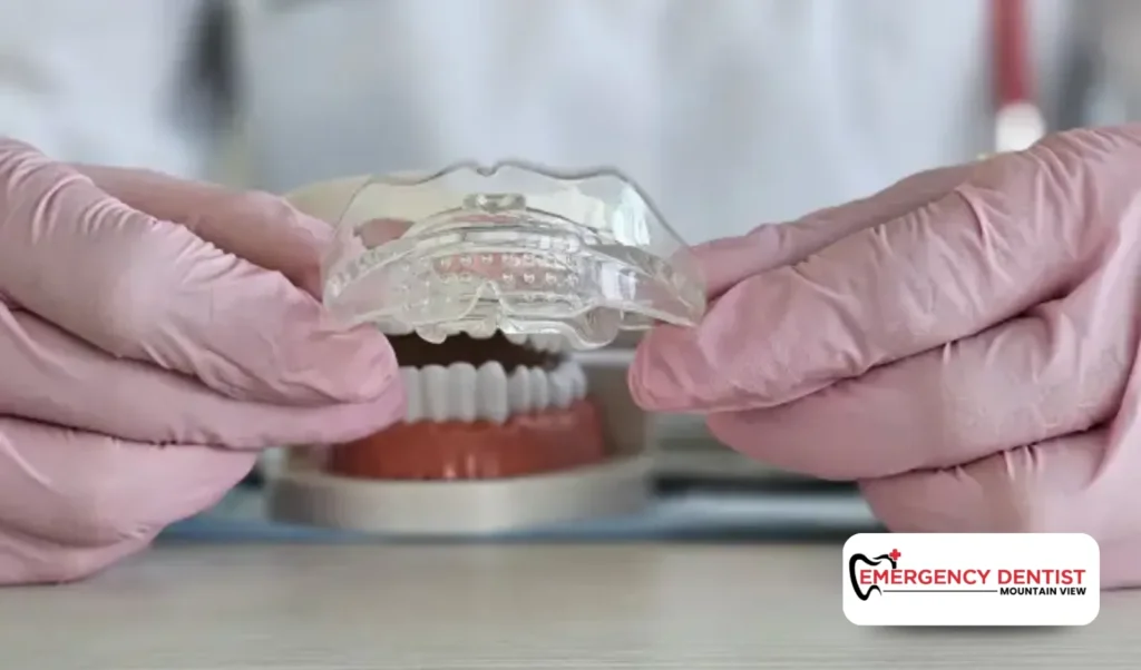 Why Custom Mouthguards Are the Best Choice