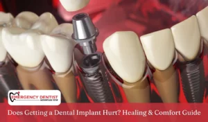 Does Getting a Dental Implant Hurt Healing & Comfort Guide