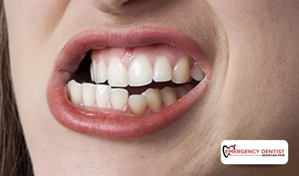 Factors That Affect Implant Longevity