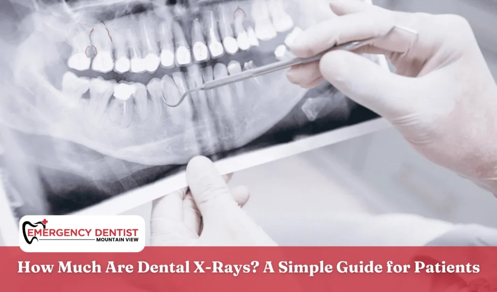 How Much Are Dental X-Rays A Simple Guide for Patients