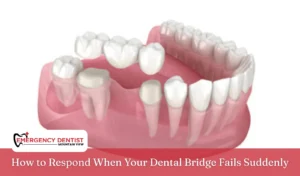 How to Respond When Your Dental Bridge Fails Suddenly