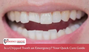 Is a Chipped Tooth an Emergency Your Quick Care Guide