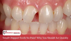 Small Chipped Tooth No Pain Why You Should Act Quickly