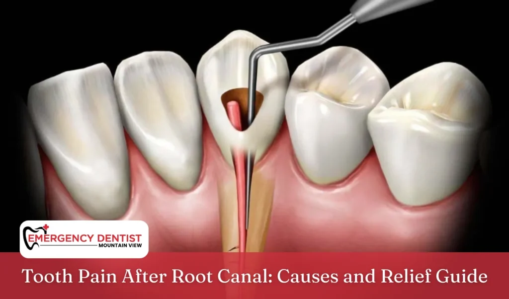 Tooth Pain After Root Canal Causes and Relief Guide