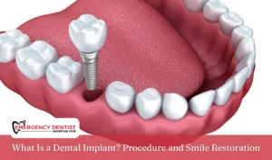 What Is a Dental Implant Procedure and Smile Restoration