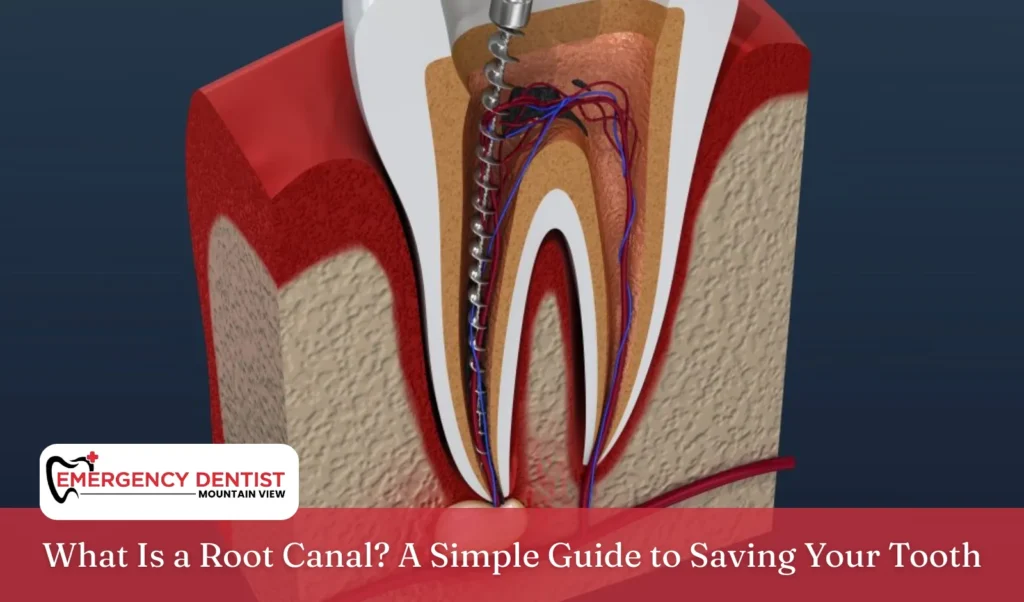 What Is a Root Canal A Simple Guide to Saving Your Tooth