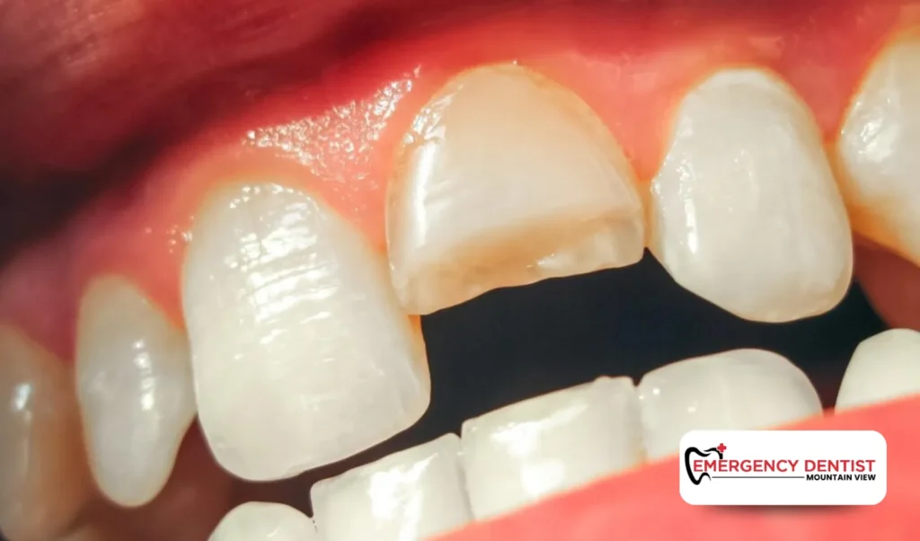 Why You May Need Emergency Dentistry