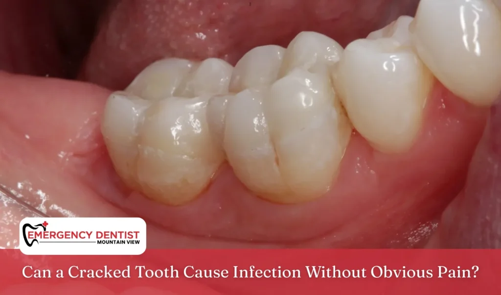 Can a Cracked Tooth Cause Infection Without Obvious Pain