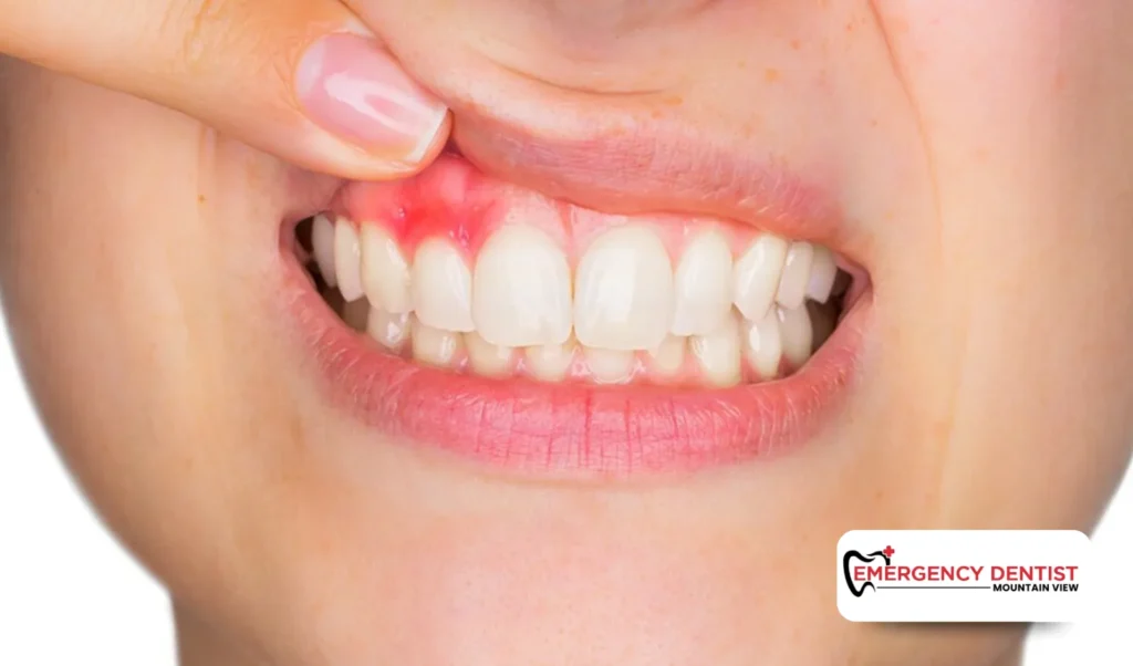 Common Symptoms You May Notice