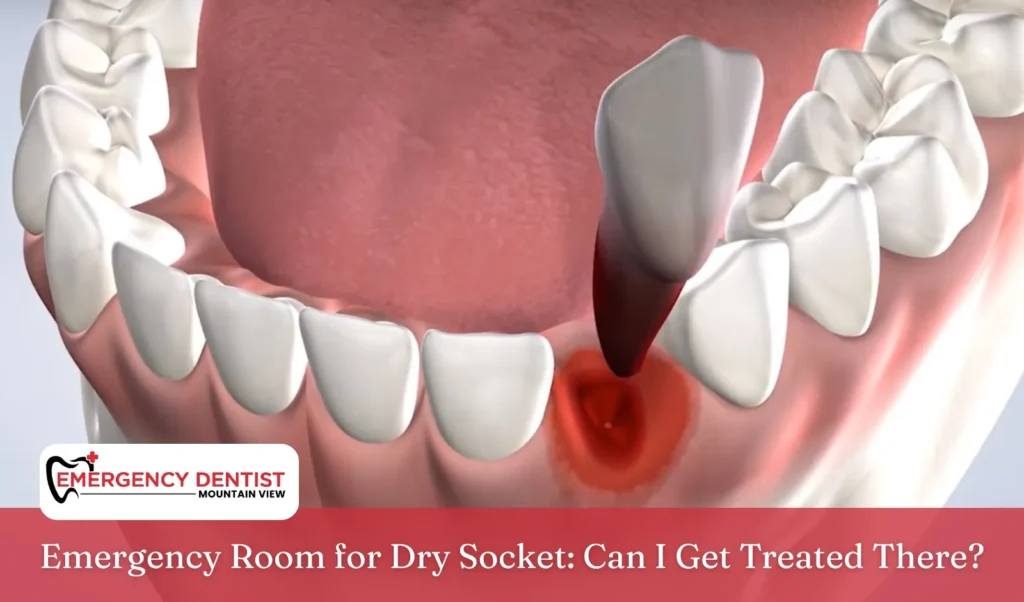 Emergency Room for Dry Socket Can I Get Treated There