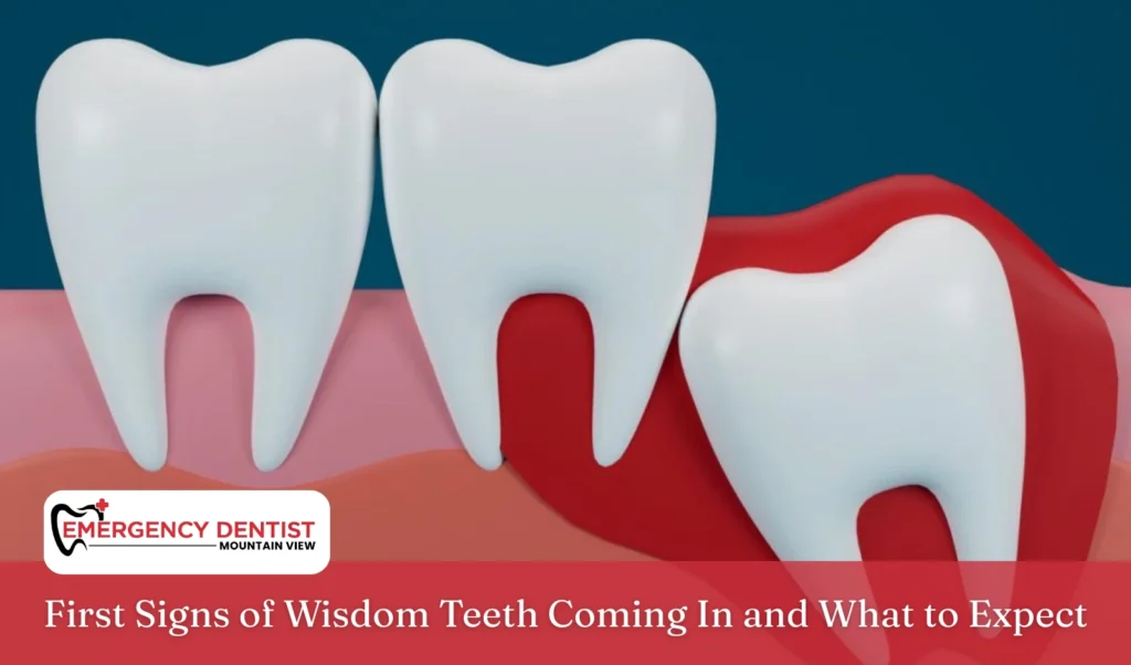 First Signs of Wisdom Teeth Coming In and What to Expect