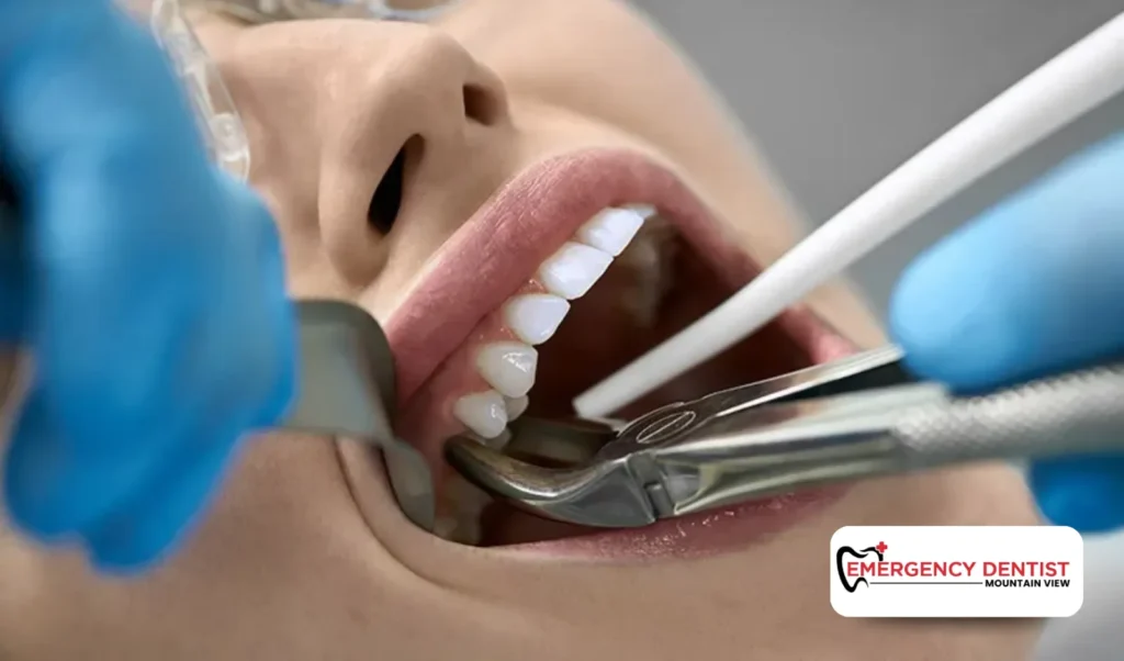 How Dentists Handle Tooth Extractions