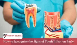 How to Recognize the Signs of Tooth Infection Early