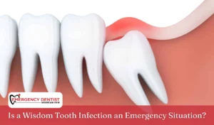 Is a Wisdom Tooth Infection an Emergency Situation