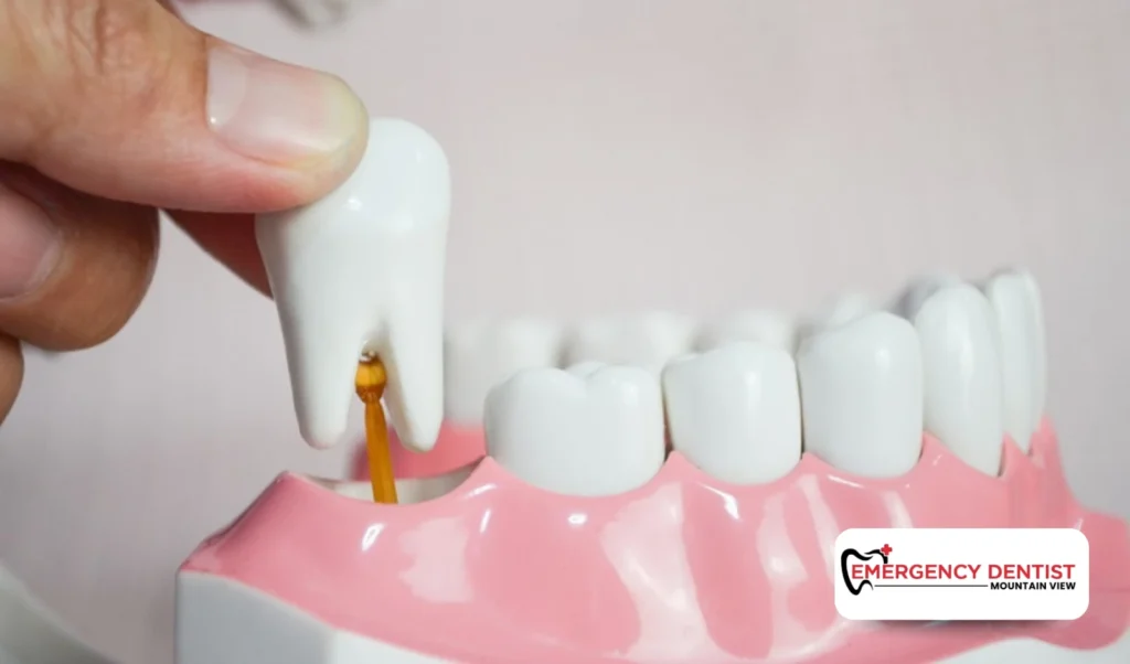 When Do Wisdom Teeth Come In