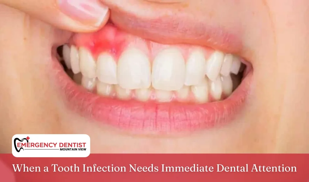 When a Tooth Infection Needs Immediate Dental Attention