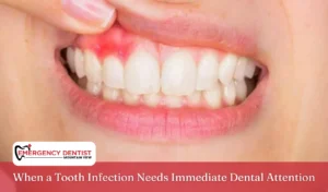 When a Tooth Infection Needs Immediate Dental Attention