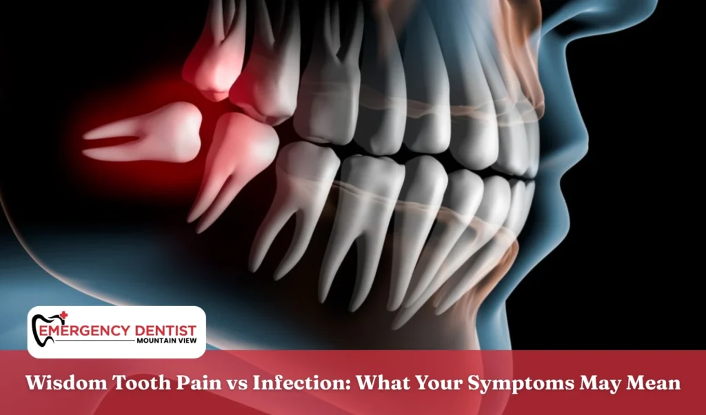 Wisdom Tooth Pain vs Infection What Your Symptoms May Mean